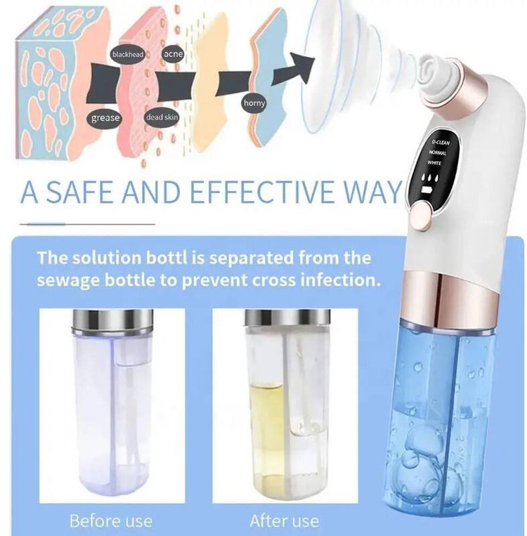 میکرودرم آبریژن اسکوم دار micro bubble